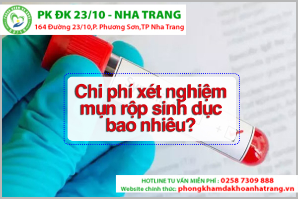  Chi phí xét nghiệm mụn rộp sinh dục ảnh hưởng bởi phương pháp thực hiện
