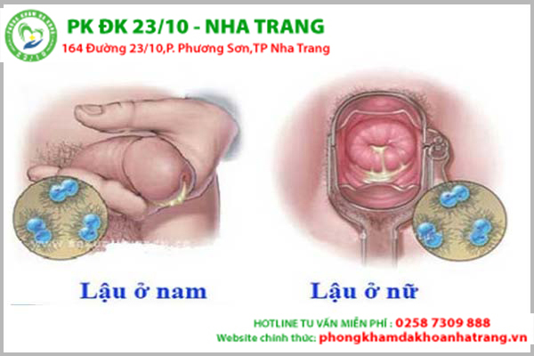 Lý giải hiện tượng tiểu buốt, tiểu rắt, tiểu ra máu