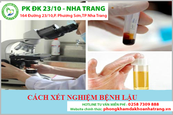 Xét nghiệm lậu bước quan trọng để phát hiện bệnh