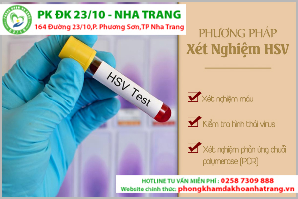 Xét nghiệm herpes hay xét nghiệm HSV bằng cách lấy máu