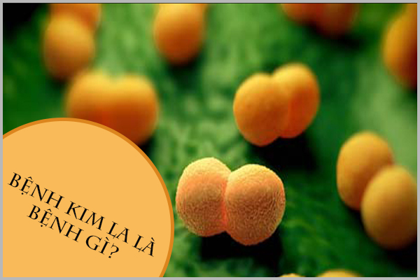 BỆNH KIM LA LÀ BỆNH GÌ?