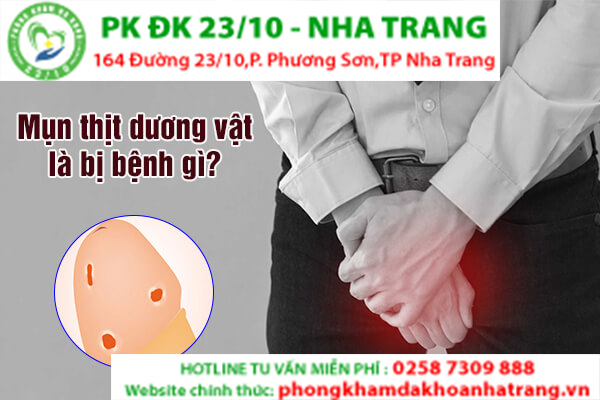  Mụn thịt ở dương vật là dấu hiệu sùi mào gà