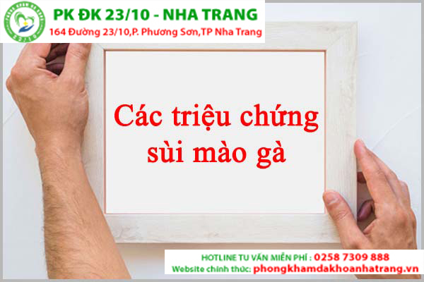 NHẬN BIẾT CHUẨN XÁC CÁC TRIỆU CHỨNG SÙI MÀO GÀ