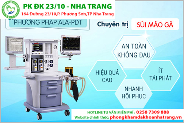 Phương pháp hỗ trợ điều trị sùi mào gà hiện đại ALA-PDT