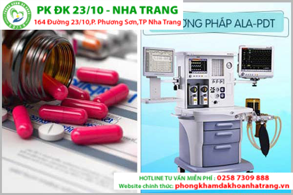 phuong phap dieu tri luoi noi hot